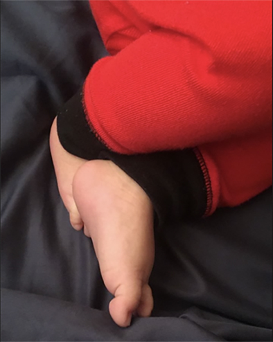 piecitos